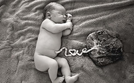 “탯줄 안 자르는 ‘연꽃출산’, 감염 위험” …英전문가 경고