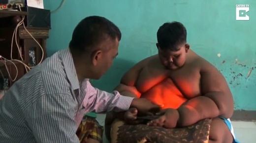 190kg 인도네시아 10세 소년, 세 달 감량…성과는?