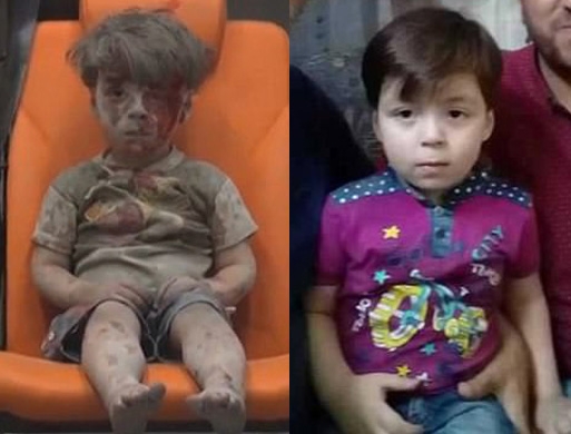 [월드피플+] 전세계 울린 ‘알레포 소년’ 건강하게 돌아오다