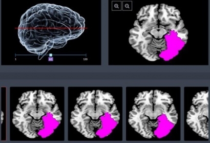 ㈜제이엘케이인스펙션, 국내 최초로 인공지능(AI)을 활용 의료기기 허가 절차 돌입