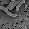 김치 유산균 관련 연구결과 발표, 헬리코박터균 감염 억제효과 나타나