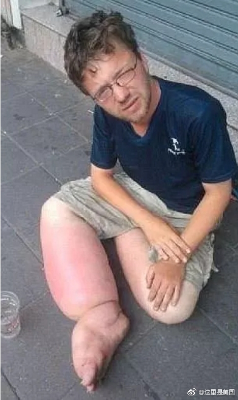 독일남자, 아시아 각국 돌며 낮에는 구걸, 밤에는 유흥업소