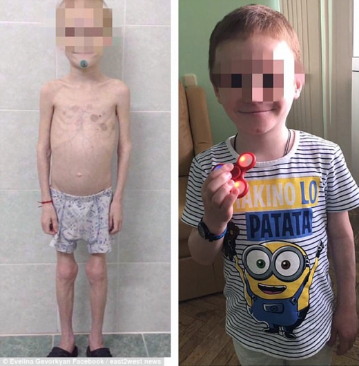 11세 몸무게 13㎏…새엄마가 8년 동안 아들 굶긴 이유?