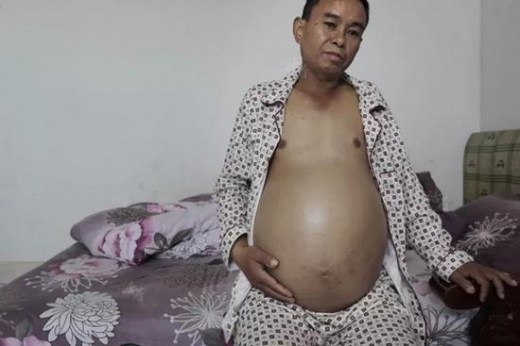 ‘죽음의 땅’으로 변한 中 광산 지역 르포