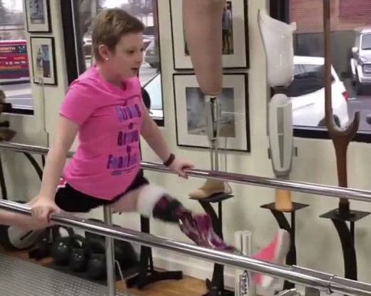 “춤이 좋으니까요”…다리 잃고도 꿈 포기 않은 소녀