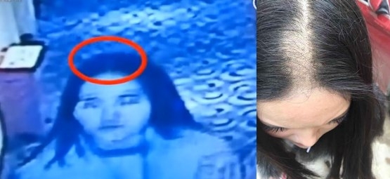 [여기는 중국] 호텔 숙박 하루 만에 심각한 탈모…여성 고객 논란