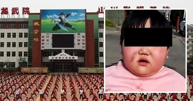 [여기는 중국] 살 빼러 소림사 들어간 7세 소녀 이틀만에 사망