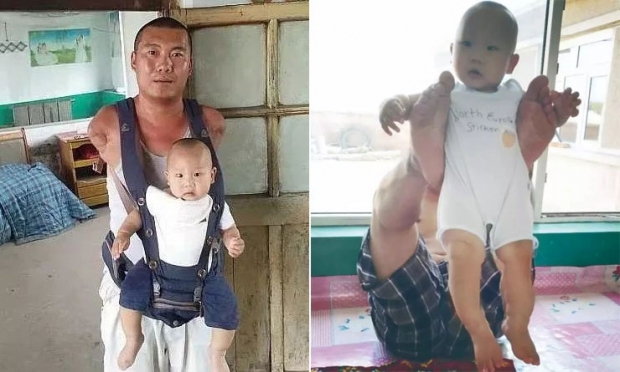 [월드피플+] 두 팔이 없어 두 발로 아이 양육하는 中남성의 사연