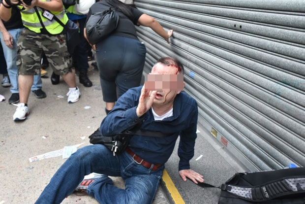 홍콩 시위대, 사진 찍던 日 남성을 중국인으로 오인해 폭행