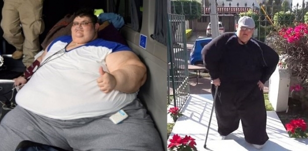 무려 590㎏ 세계서 가장 뚱뚱한 남자 3년 후…체중 330㎏ 뺐다