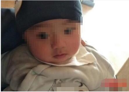 中 3세 아이, 끓는 기름에 빠져 중상…이웃 225명 헌혈 나서