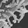 현미경으로 확인한 코로나19 ‘좀비촉수’…건강한 세포로 파도타기
