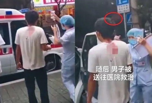 [여기는 중국] 하늘에서 떨어진 칼날…행인 남성 머리에 날아와 박혀
