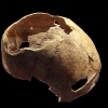 [핵잼 사이언스] 5000년전 ‘뇌 수술’ 받은 20대 남성, 생존했을까
