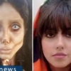 안젤리나 졸리 닮고싶어 50차례 성형한 이란 여성 ‘징역 10년형’