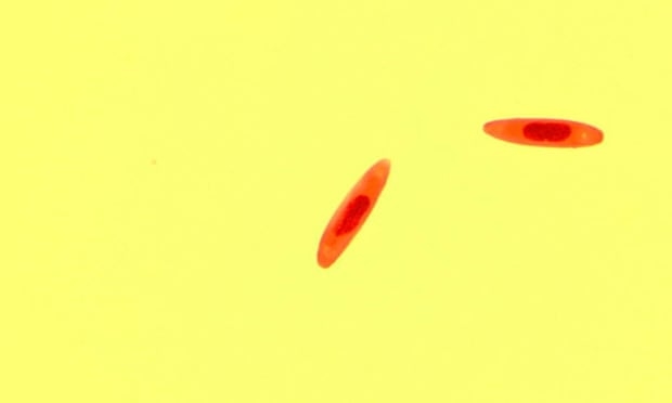 [와우! 과학] ‘좀비 파리’ 만드는 신종 균류 발견… “죽지 않고 바이러스 전파”