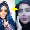 성형 50번으로 ‘좀비’된 이란 여성, 실제 얼굴 최초 공개