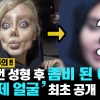 [이슈플릭스] 안젤리나 졸리 닮고싶어 50번 성형한 여성, 진짜 얼굴 공개