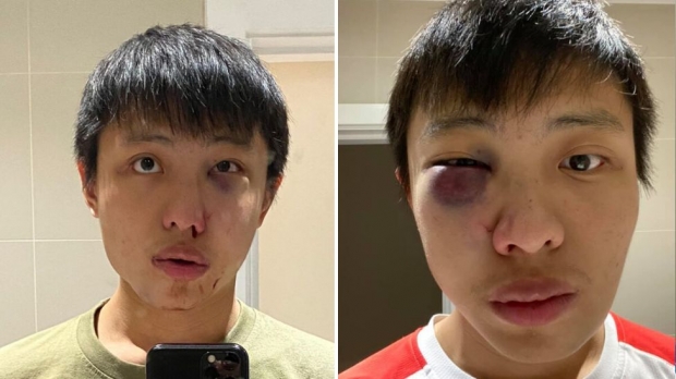 “아시아의 코로나, 싫다!” 인종차별적 폭행한 10대에 유죄 선고한 英법원