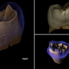 [핵잼 사이언스] 네안데르탈인도 이쑤시개 썼나…화석서 긁어낸 흔적 발견