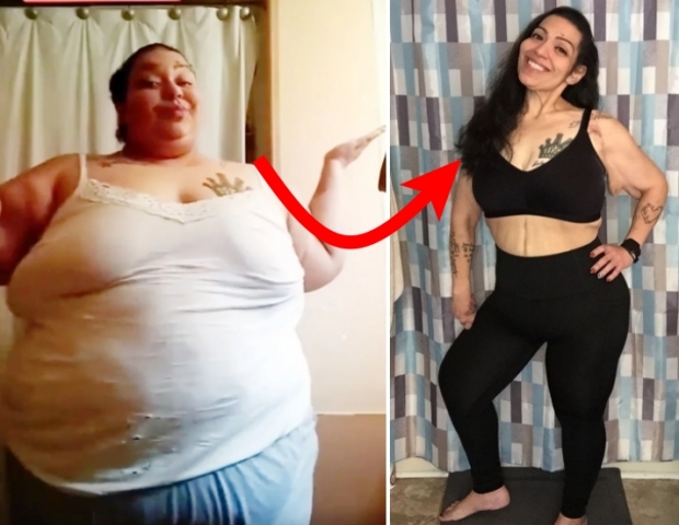 ‘227㎏→80㎏’ 뇌수술 받으려 약 150㎏ 감량한 美여성