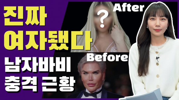 진짜 여자가 된 ‘남자 바비인형’의 근황 공개