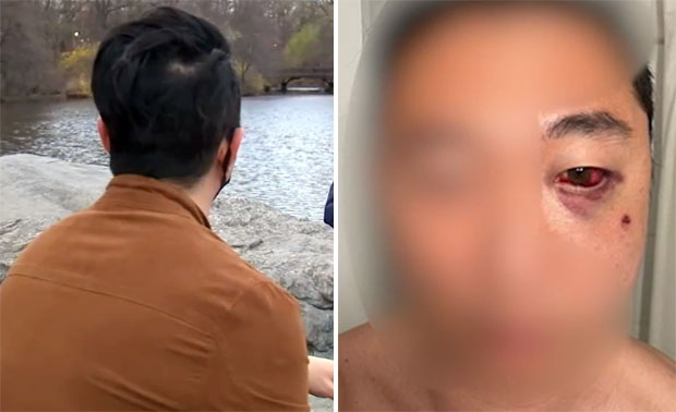 “동양인 어드밴티지” 5살 앞에서 주먹 날려…아시아계 가족 봉변
