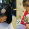 [여기는 중국] 고양이 입양 후 탈모 증세 나타난 中 소녀의 사연