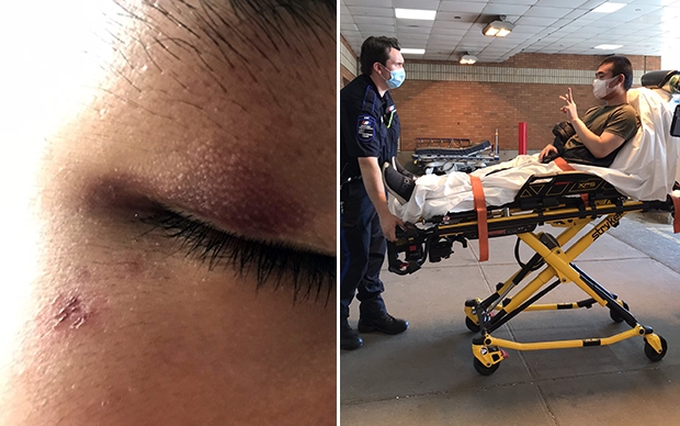 “칭총(동양인 비하)”…美 아시아계 15세 소년 집단 구타 당해