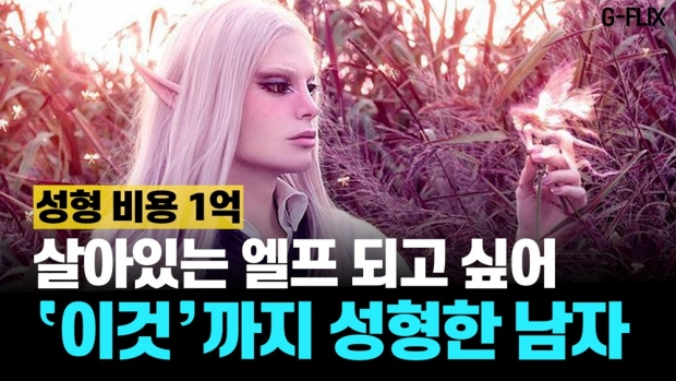 [이슈플릭스] ‘살아있는 엘프’ 되려고 수술비 1억 쓴 남성의 사연