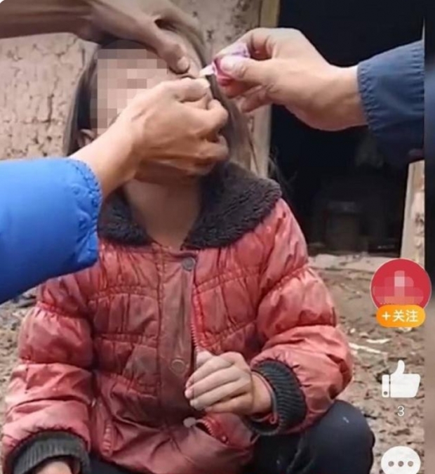 [여기는 중국] 인공 눈물 넣고 꼬집기까지…中 가짜 불우이웃돕기 사기 기승