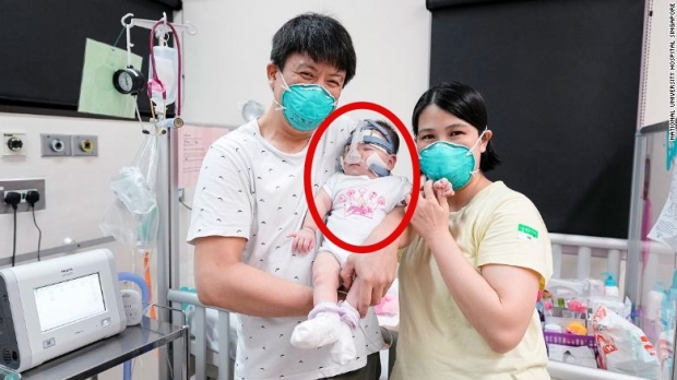 [월드피플+] 세계서 가장 작은 212g 조산아, 1년 만에 기적 퇴원