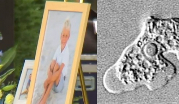 ‘뇌 먹는 아메바’로 연이어…美 6세 소년, 감염 후 사망