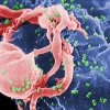 ‘슈퍼 면역력’으로 에이즈 자연 치유…두 번째 완치자 나왔다