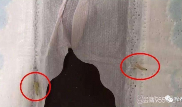 [여기는 중국]생리대에 유충이 ‘득실득실’...알고보니 고가의 美수입 브랜드