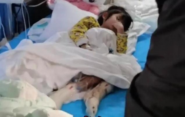 [여기는 중국]친딸 다리에 뜨거운 물 붓고 방치한 父...절단 수술 위기