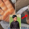 “아빠”…25m 우물에 빠진 아프간 소년, 탈레반 총력 구조에도 결국 사망