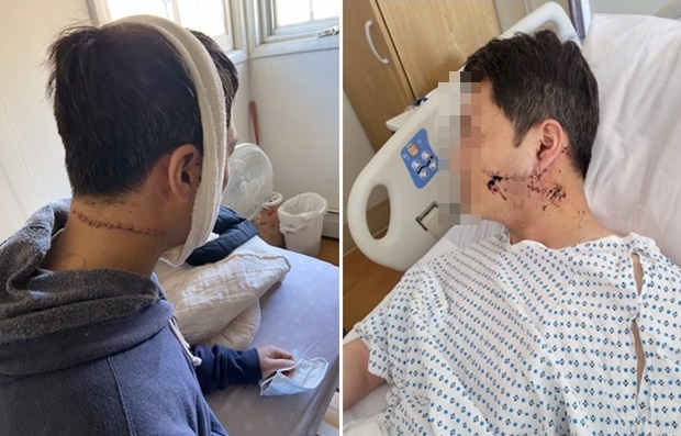 “아시아로 돌아가!” 美 뉴욕서 30대 한국계 남성 ‘커터칼 테러’