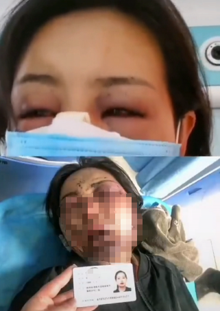 [여기는 중국] “악마 남편을 고발합니다”...中 고위간부 아내 상습폭행