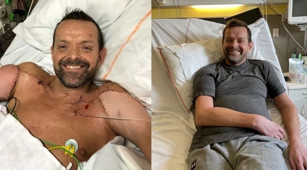 [월드피플+] “이제 딸 안을 수 있어” 세계 최초 ‘양팔+어깨 이식’ 한 남자