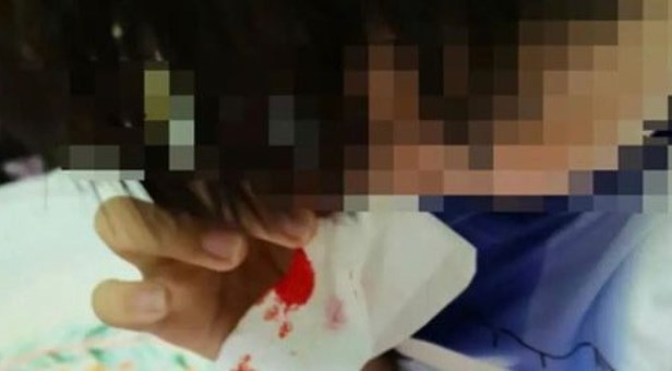 [여기는 중국] “엄마, 자꾸 코피가 나요”…中 초등생 100명 집단 이상 발병