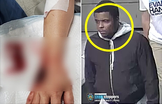 “동양인이라 당했다”…美 뉴욕 한복판 아시아계 여성 ‘커터칼 테러’