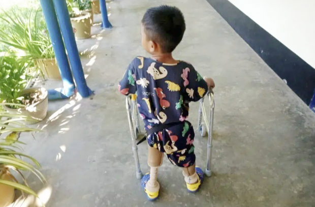지뢰에 다리 잃은 3살 아이…‘인간 방패’ 쓰는 잔혹한 미얀마 군인들
