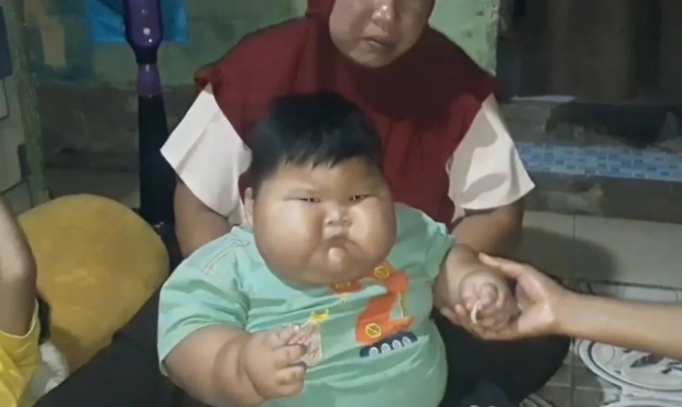 또래 3배 크기…‘아빠 옷’ 입는 인니 16개월 아기의 사연
