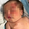 사람보다 인간적인…유기견, 봉지에 유기된 레바논 아기 구했다