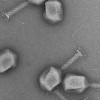 세균 먹는 바이러스로 세균 감염을 진단한다 (연구)
