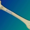 ‘진짜 뼈’로 바뀌는 3D 프린팅 출력 인공 뼈 [와우! 과학]