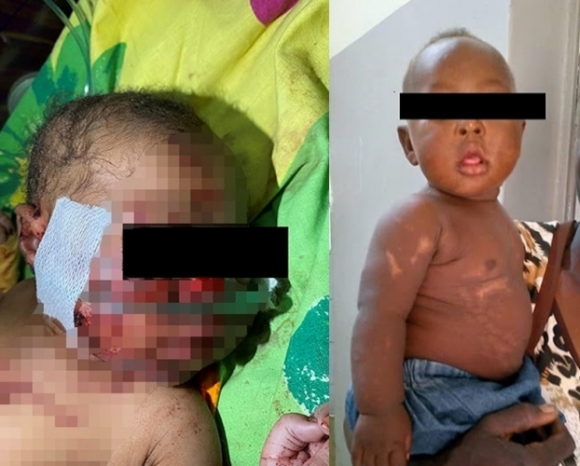 기적이 일어났다…엄마가 생매장한 신생아, 6시간 만에 구조돼 생존[월드피플+]