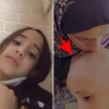 [포착] “엄마, 죽고 싶어요” 머리 다 빠진 8세 소녀 사연…전쟁의 참혹한 민낯