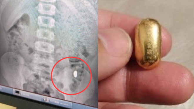 “밖에서 화장실 금지”…11세 아들에게 ‘극단적 조치’ 내린 이유는?